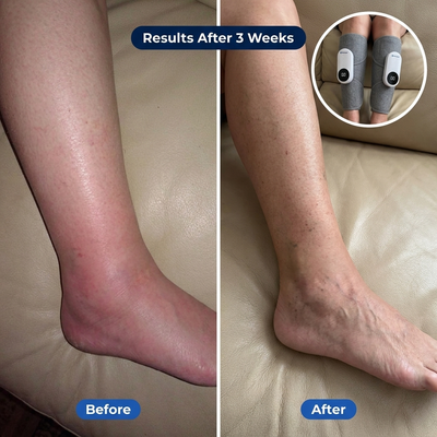 Restique™ Dual-Therapy Leg System